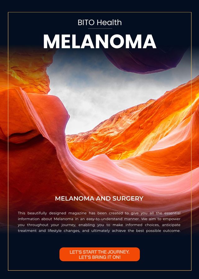 Melanoma guide
