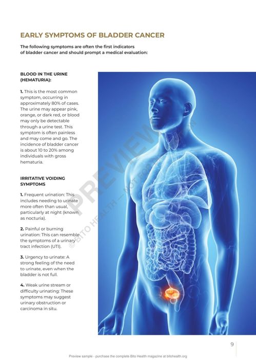Sample page from the Bladder Cancer guide