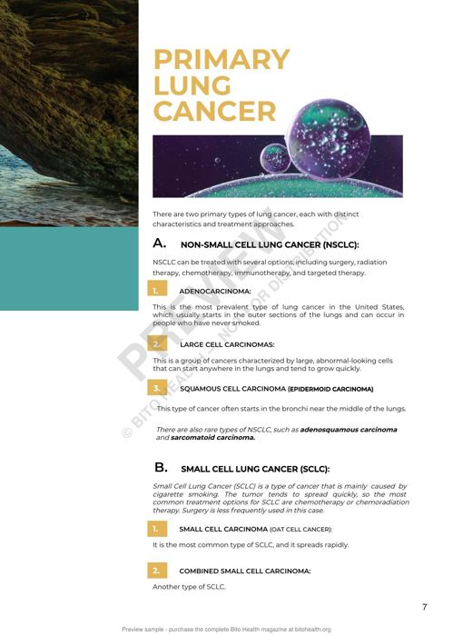 Sample page from the Lung Cancer guide