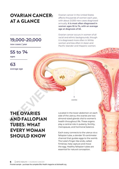 Sample page from the Ovarian Cancer guide