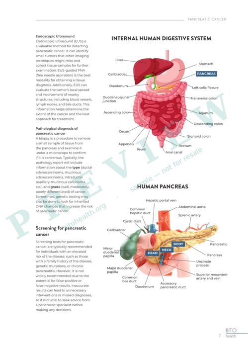 Sample page from the Pancreatic Cancer guide